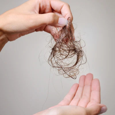 Postpartum &menopausalhair loss